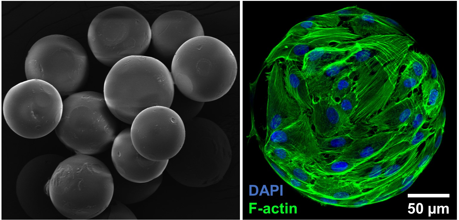 Osteogenic microtissues. Adult stem cells seeded on biomaterial micro constructs and differentiated in to bone cells.